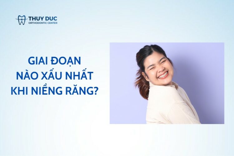 Tiết lộ giai đoạn xấu nhất khi niềng răng, làm gì để niềng mà vẫn tự tin?