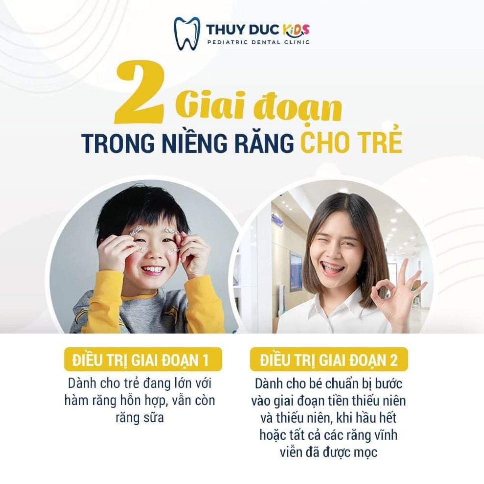 Các phương pháp chỉnh nha phù hợp cho trẻ 6 tuổi 1