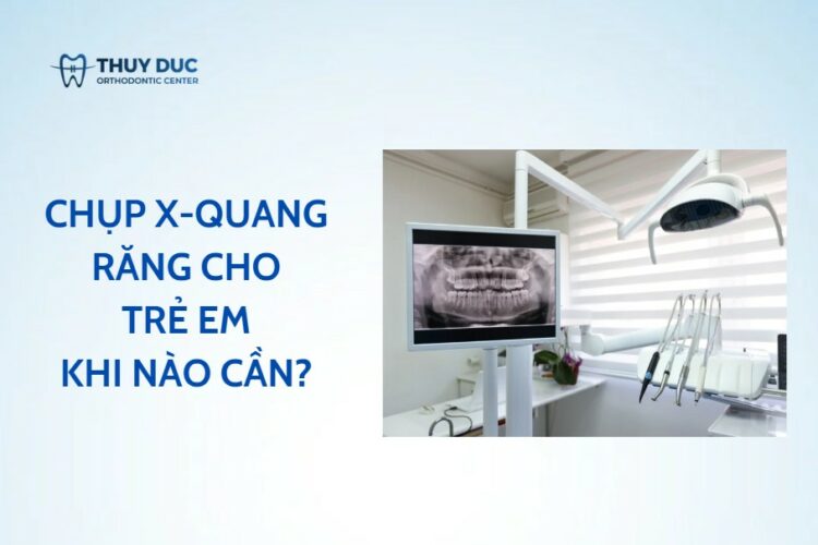 Chụp X-quang răng cho trẻ em: An toàn hay tiềm ẩn rủi ro?