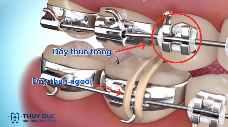 1. Phân loại theo vị trí gắn 1 1. Phân loại theo vị trí gắn 1