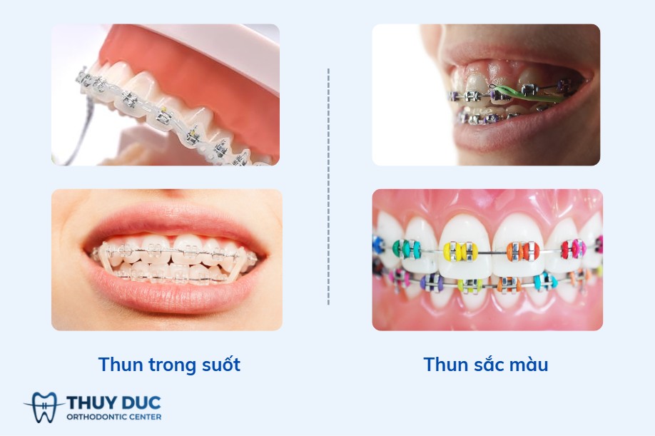 3. Phân loại theo màu sắc và mục đích thẩm mỹ 1 3. Phân loại theo màu sắc và mục đích thẩm mỹ 1