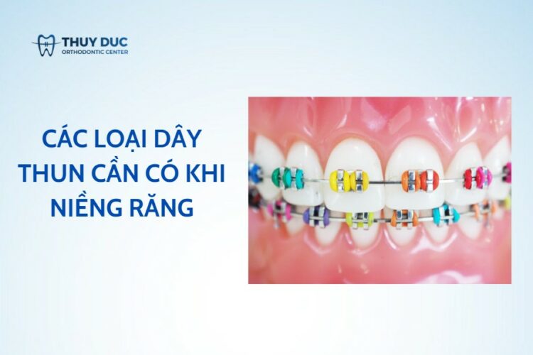 Các loại dây thun cần có khi niềng răng
