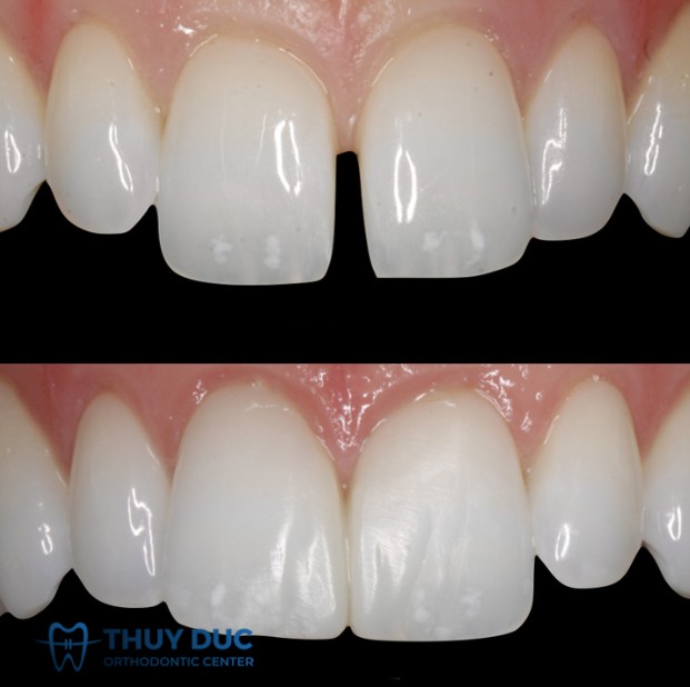 2. So sánh về hiệu quả lâu dài 1