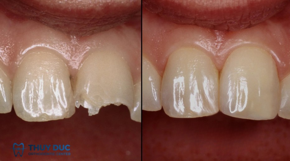 Khác nhau về mục tiêu điều trị 1