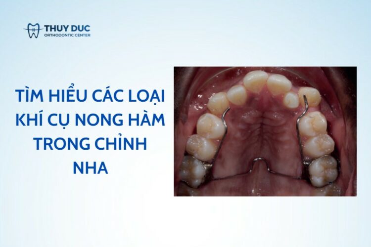 Khí cụ nong hàm – đặc điểm, trường hợp sử dụng