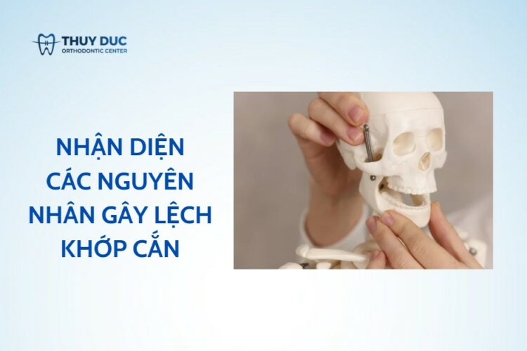 Tiết lộ các nguyên nhân gây lệch khớp cắn
