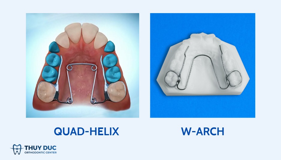 4.2. Khí cụ nong chậm (Quad-helix, W-arch, khí cụ dây) 1