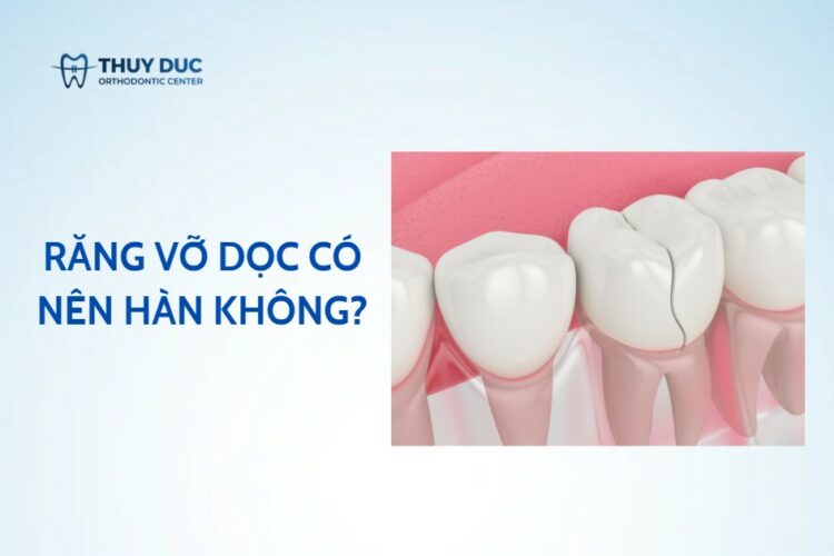Răng vỡ dọc có nên hàn không?