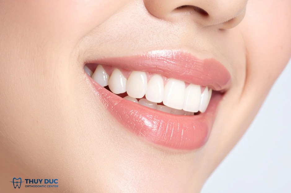 1.1. Tỷ lệ môi chuẩn 1