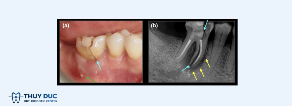 2. Nguyên nhân thường gặp 1