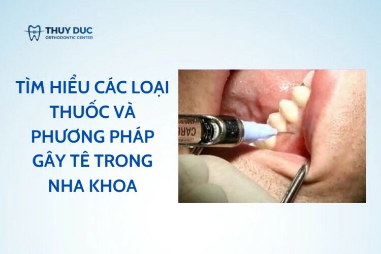 Tìm hiểu các loại thuốc và phương pháp gây tê trong nha khoa