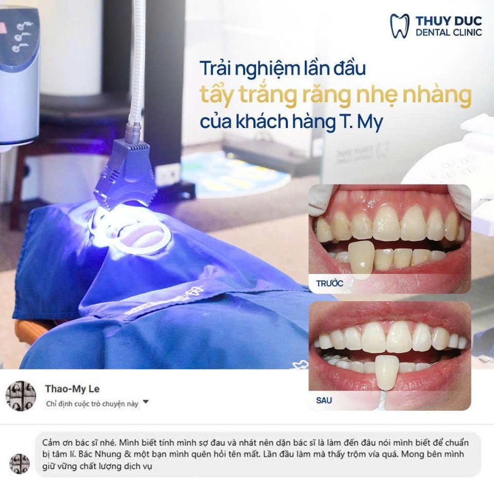 Cận cảnh quá trình tẩy trắng răng chuyên nghiệp