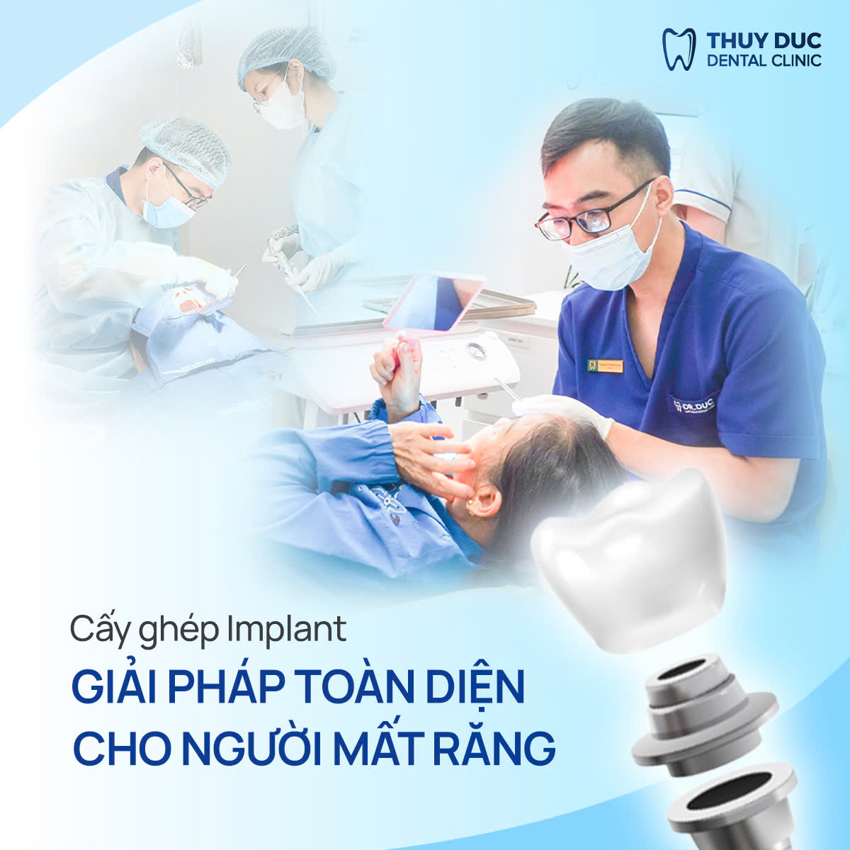 CẤY GHÉP IMPLANT TẠI NHA KHOA THÚY ĐỨC 1 CẤY GHÉP IMPLANT TẠI NHA KHOA THÚY ĐỨC 1