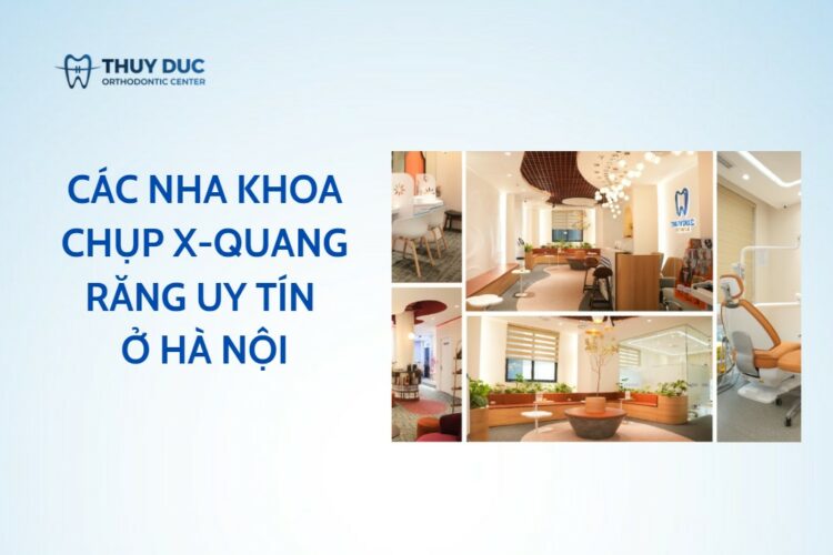 5 nha khoa chụp X-quang răng uy tín ở Hà Nội