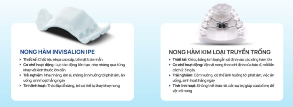 SO SÁNH NONG HÀM INVISALIGN IPE VÀ NONG HÀM TRUYỀN THỐNG 1 So sánh nong hàm