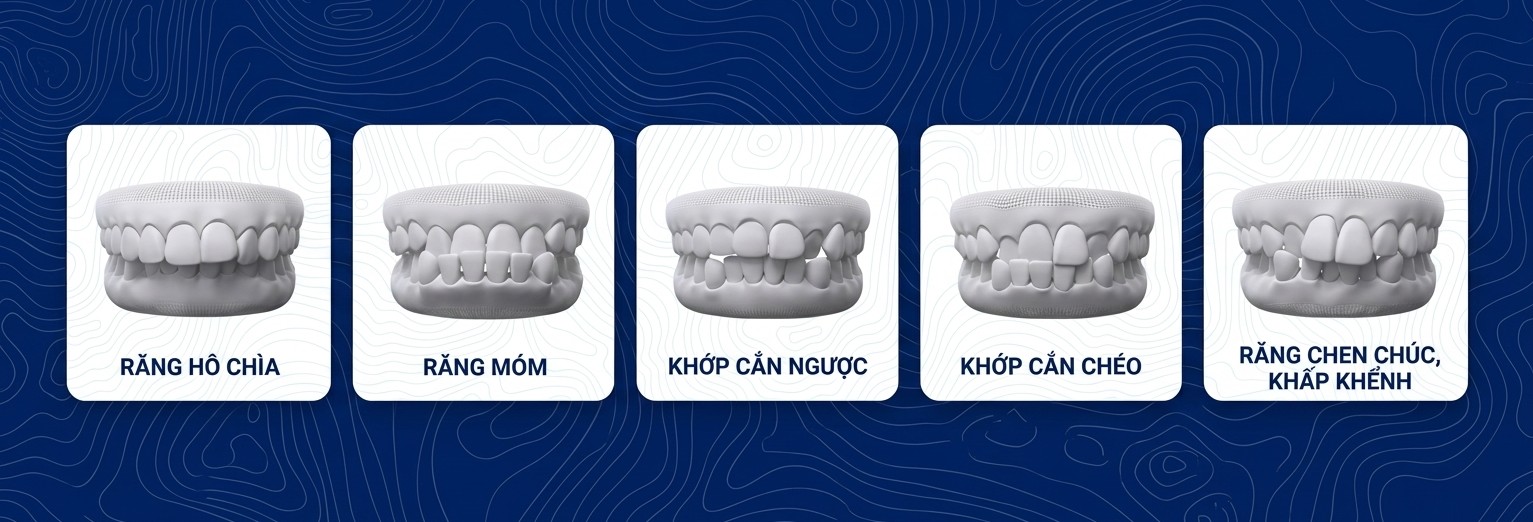 Các loại sai lệch răng có thể điều trị bằng Invisalign