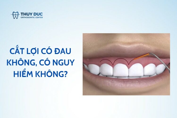 Cắt lợi có đau không, có nguy hiểm không?
