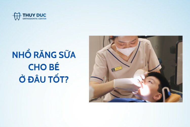 11 Địa chỉ nhổ răng sữa an toàn, uy tín tại Hà Nội