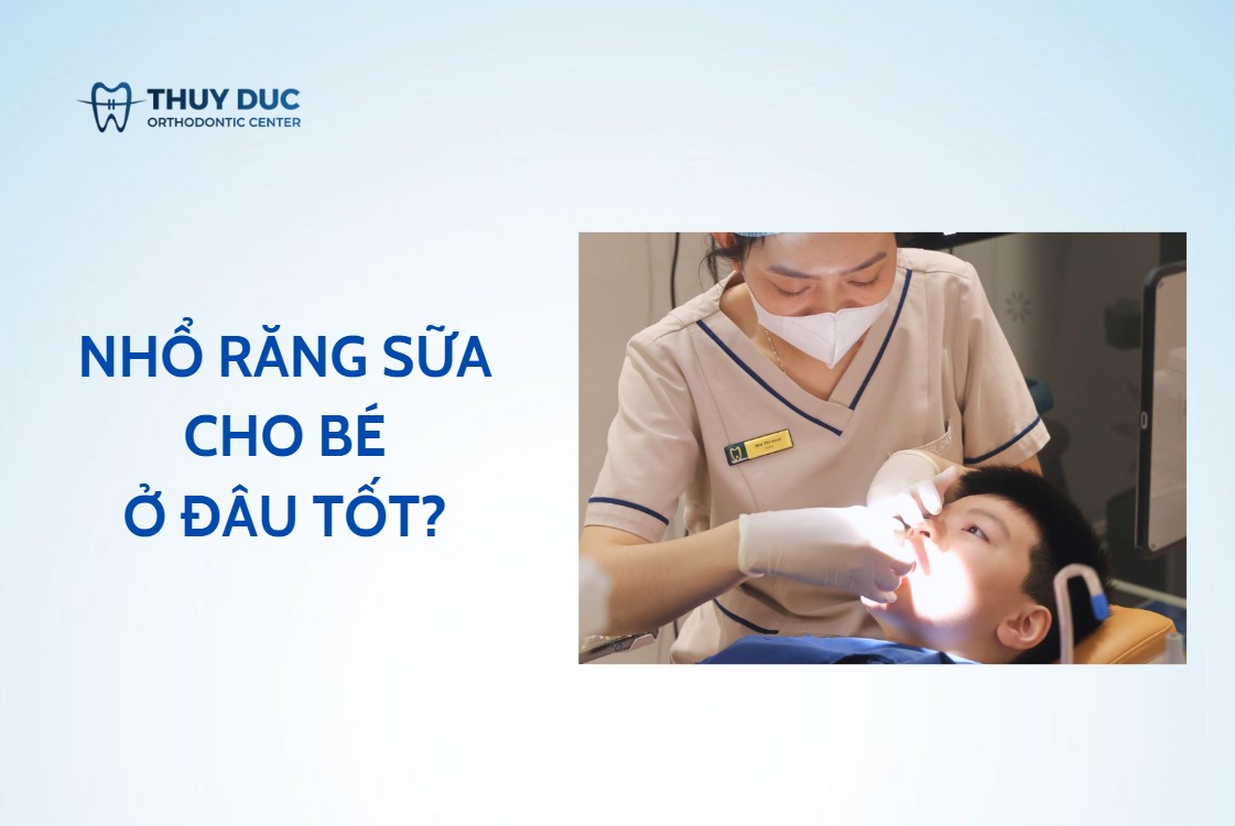 NHỔ RĂNG TRẺ EM Ở ĐÂU