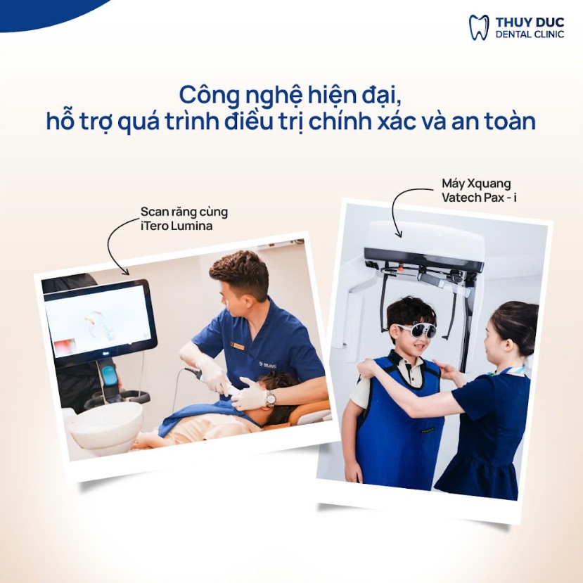 Công nghệ kỹ thuật số hiện đại giúp kiểm soát và minh bạch lộ trình 1 Công nghệ chỉnh nha hiện đại