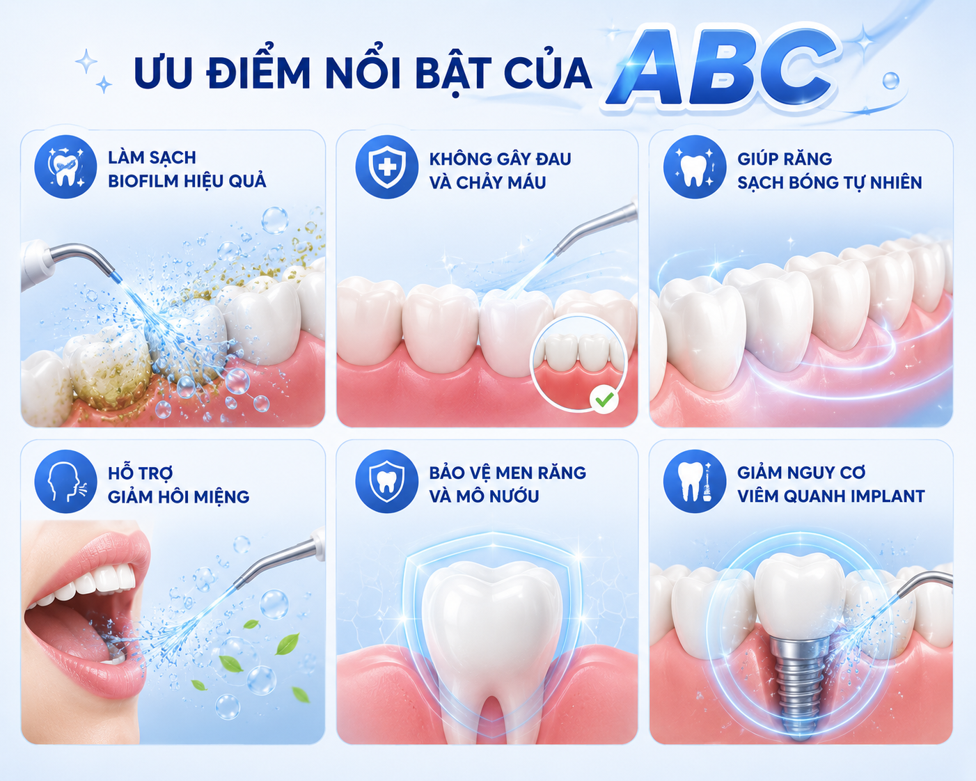Ưu điểm nổi bật của quy trình ABC 1 Ưu điểm nổi bật của quy trình ABC 1