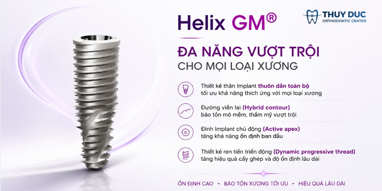 Helix GM – Dòng Implant được sử dụng phổ biến nhất 1