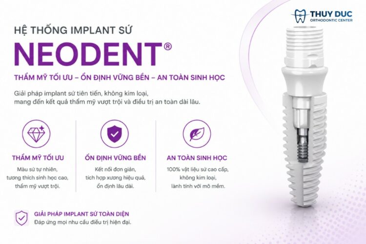 Trụ Implant Neodent – Mọi điều bạn cần biết