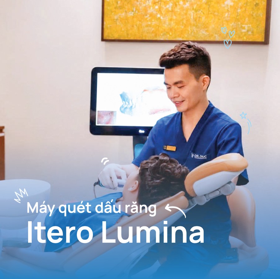 Máy quét dấu răng Itero Lumina