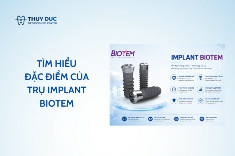 Trụ implant Biotem – Đặc điểm, ưu nhược điểm cần biết