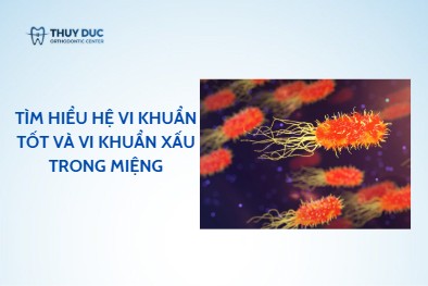 Tìm hiểu hệ vi khuẩn tốt và vi khuẩn xấu trong miệng