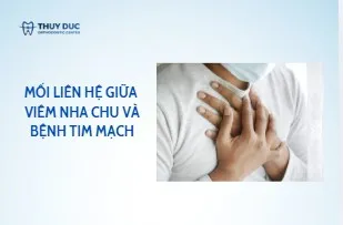 Mối liên hệ giữa viêm nha chu và bệnh tim mạch