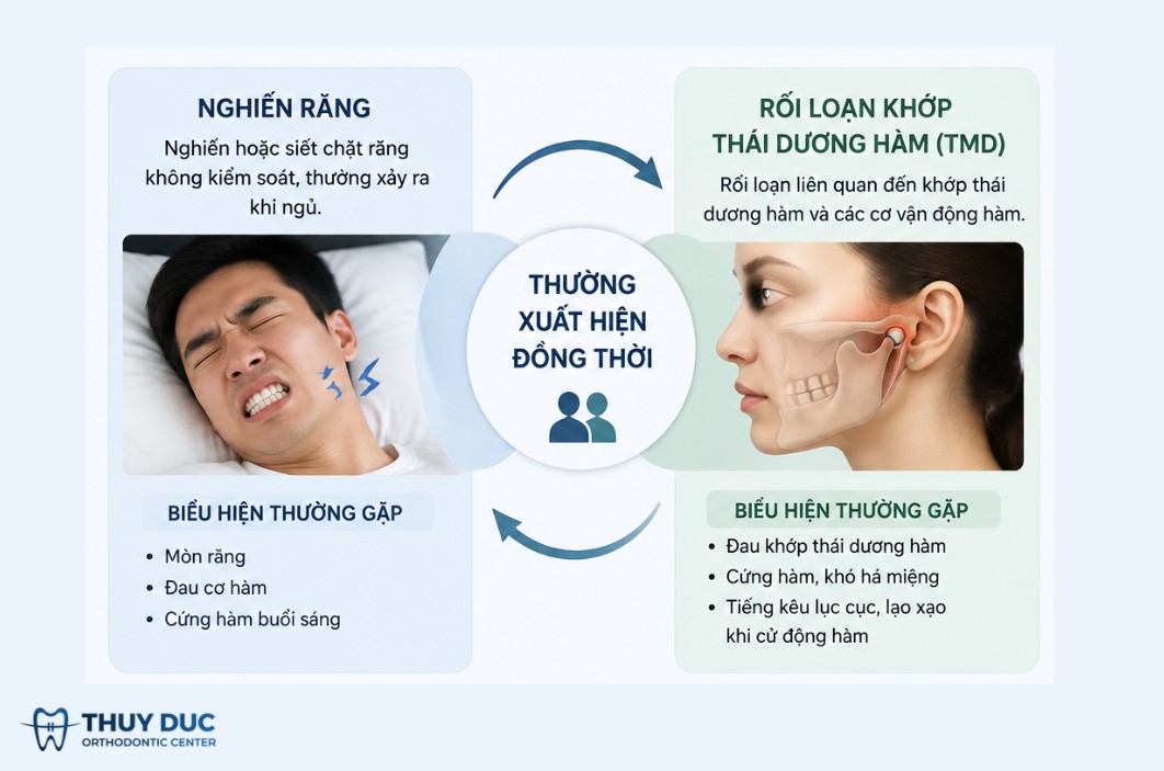 Mối liên hệ giữa nghiến răng và rối loạn khớp thái dương hàm (TMD) 1 Mối liên hệ giữa nghiến răng và rối loạn khớp thái dương hàm (TMD) 1