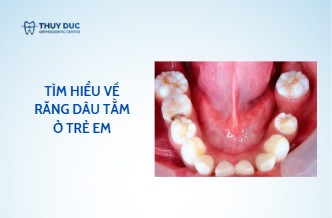 Răng dâu tằm là gì?