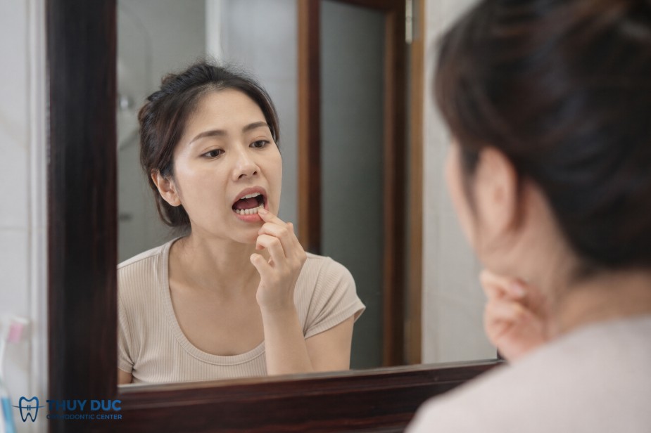 6. Răng lung lay nhẹ 1