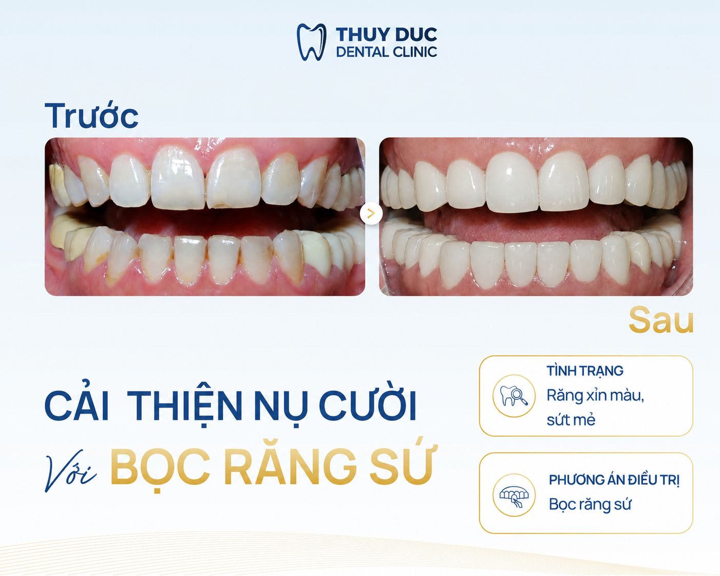 Kết quả điều trị thực tế tại Thúy Đức 1
