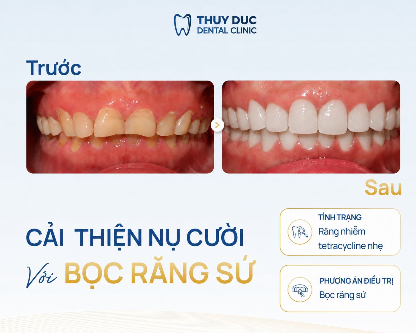 Kết quả điều trị thực tế tại Thúy Đức 2 Kết quả điều trị thực tế tại Thúy Đức 2