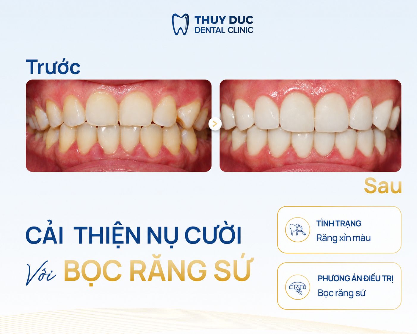 Kết quả điều trị thực tế tại Thúy Đức 3 Kết quả điều trị thực tế tại Thúy Đức 3