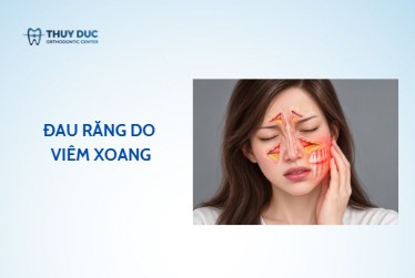 Nhận diện đặc điểm đau răng do xoang