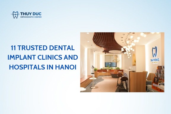 Looking for a trusted dental implant clinic in Hanoi?