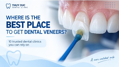 Where to get trusted teeth scaling in Hanoi?