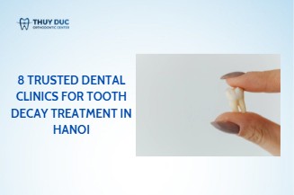 8 trusted dental clinics for tooth decay treatment in Hanoi