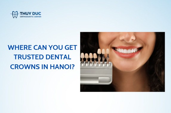 Where can you get trusted dental crowns in Hanoi?