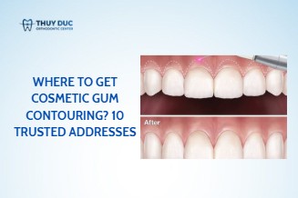 Where to get cosmetic gum contouring? 10 trusted addresses